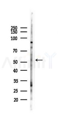 EBI2 Antibody - Western blot analysis of lysates from Hela cells(heat-shock 45min treatment), using EBI2 Antibody at 1/1000 dilution.