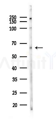 FZD10 Antibody - Western blot analysis of lysates from PC12 cells(starvation 24h treatment), using FZD10 Antibody at 1/1000 dilution.