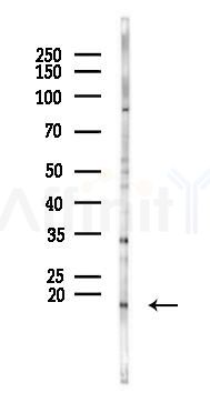 CCL19 Antibody - Western blot analysis of lysates from B16F10-LUC cells(UV 30min treatment), using CCL19 Antibody at 1/1000 dilution.
