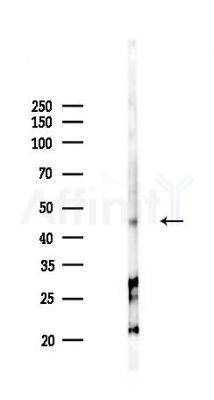 CCR9 Antibody - Western blot analysis of lysates from COLO205 cells(starvation 24h treatment), using CCR9 Antibody at 1/1000 dilution.