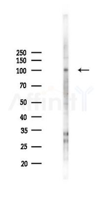 DGCR8 Antibody - Western blot analysis of lysates from COLO205 cells(starvation 24h treatment), using DGCR8 Antibody at 1/1000 dilution.