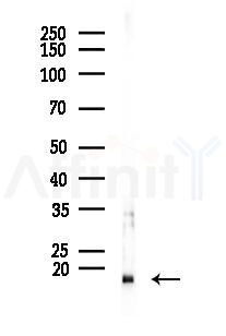 Acetyl-Histone H2A (Lys9) Antibody - Western blot analysis of lysates from B16F10-LUC cells(UV 30min treatment), using Acetyl-Histone H2A (Lys9) Antibody at 1/1000 dilution.