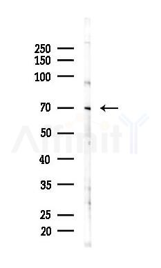 KIFC1 Antibody - Western blot analysis of lysates from PC12 cells(starvation 24h treatment), using KIFC1 Antibody at 1/1000 dilution.