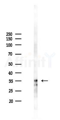 SNF5 Antibody - Western blot analysis of lysates from COLO205 cells(starvation 24h treatment), using SNF5 Antibody at 1/1000 dilution.