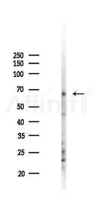 Phospho-SAMHD1 (Thr592) Antibody - Western blot analysis of lysates from COLO205 cells(starvation 24h treatment), using Phospho-SAMHD1 (Thr592) Antibody at 1/1000 dilution.