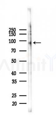Phospho-beta Catenin (Ser33/Ser37/Thr41) Antibody - Western blot analysis of lysates from RAW264.