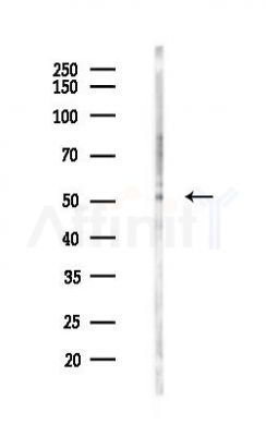 TRIM38 Antibody - Western blot analysis of lysates from HUVEC cells(LPS 4h treatment), using TRIM38 Antibody at 1/1000 dilution.