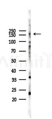 DGKI Antibody - Western blot analysis of lysates from 293 cells(LPS 4h treatment), using DGKI Antibody at 1/1000 dilution.