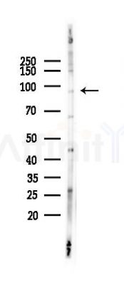 TOP3B Antibody - Western blot analysis of lysates from K562 cells(LPS 4h treatment), using TOP3B Antibody at 1/1000 dilution.