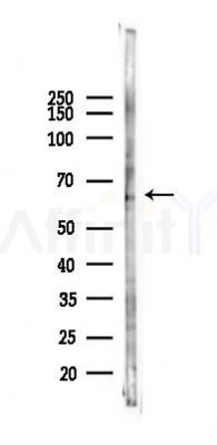 TFE3 Antibody - Western blot analysis of lysates from PC12 cells(heat-shock 45min treatment), using TFE3 Antibody at 1/1000 dilution.