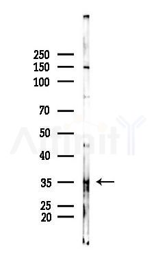 FOXN2 Antibody - Western blot analysis of lysates from HUVEC cells(starvation 24h treatment), using FOXN2 Antibody at 1/1000 dilution.