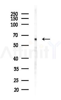 TF2H1 Antibody - Western blot analysis of lysates from Hela cells(heat-shock 24h treatment), using TF2H1 Antibody at 1/1000 dilution.