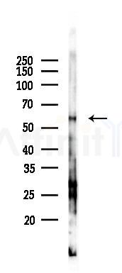 CSK Antibody - Western blot analysis of lysates from HUVEC cells(starvation 24h treatment), using CSK Antibody at 1/1000 dilution.
