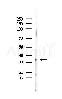 HOXA1 Antibody - Western blot analysis of lysates from Rat lung, using HOXA1 Antibody at 1/1000 dilution.