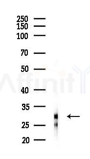SSBP2 Antibody - Western blot analysis of lysates from Hela cells(heat-shock 24h treatment), using SSBP2 Antibody at 1/1000 dilution.