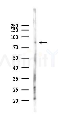 TLE2 Antibody - Western blot analysis of lysates from Hela cells(LPS 4h treatment), using TLE2 Antibody at 1/1000 dilution.