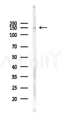 CAF1A Antibody - Western blot analysis of lysates from 293 cells(LPS 4h treatment), using CAF1A Antibody at 1/1000 dilution.