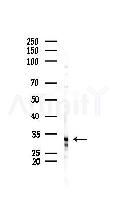 FOXE3 Antibody - Western blot analysis of lysates from HUVEC cells(starvation 24h treatment), using FOXE3 Antibody at 1/1000 dilution.