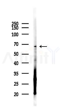 GCKR Antibody - Western blot analysis of lysates from Hela cells(LPS 4h treatment), using GCKR Antibody at 1/1000 dilution.