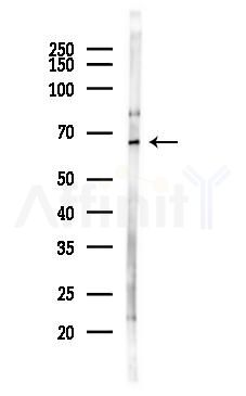 GCKR Antibody - Western blot analysis of lysates from Rat kidney, using GCKR Antibody at 1/1000 dilution.
