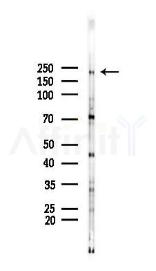 ZNF638 Antibody - Western blot analysis of lysates from Mouse brain, using ZNF638 Antibody at 1/1000 dilution.