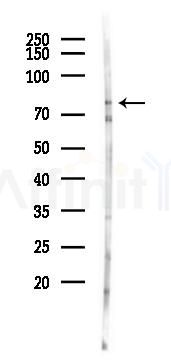 FAKD3 Antibody - Western blot analysis of lysates from 293 cells(LPS 4h treatment), using FAKD3 Antibody at 1/1000 dilution.