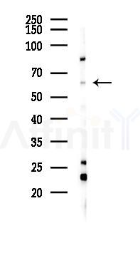 CERKL Antibody - Western blot analysis of lysates from 293 cells(LPS 4h treatment), using CERKL Antibody at 1/1000 dilution.