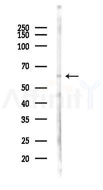 ARMCX2 Antibody - Western blot analysis of lysates from Rat kidney, using ARMCX2 Antibody at 1/1000 dilution.
