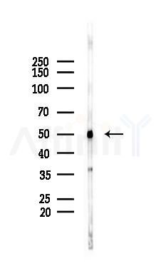 DOK3 Antibody - Western blot analysis of lysates from PC12 cells(starvation 24h treatment), using DOK3 Antibody at 1/1000 dilution.