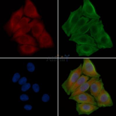 DOK3 Antibody - DF3331 staining Hela cells(30min of UV treatment) by IF/ICC.