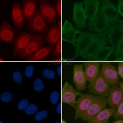 STRAD Antibody - DF3334 staining Hela cells(45min of heat-shock treatment) by IF/ICC.