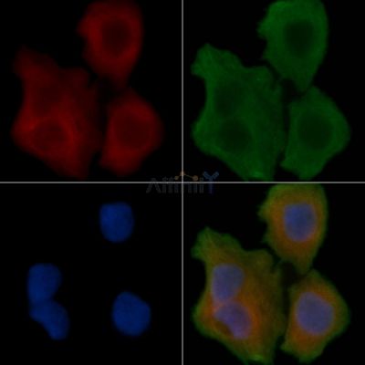 CAMK5 Antibody - DF3351 staining Hela cells(30min of UV treatment) by IF/ICC.