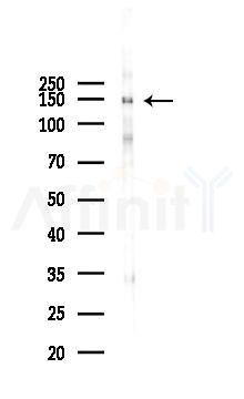 ZNF541 Antibody - Western blot analysis of lysates from Hela cells(LPS 4h treatment), using ZNF541 Antibody at 1/1000 dilution.