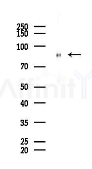 SEMA4A Antibody - Western blot analysis of lysates from Rat kidney, using SEMA4A Antibody at 1/1000 dilution.