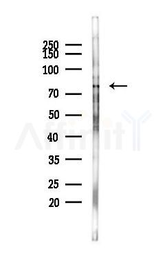 MED17 Antibody - Western blot analysis of lysates from 293 cells(heat-shock 45min treatment), using MED17 Antibody at 1/1000 dilution.