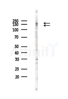 TRPS1 Antibody - Western blot analysis of lysates from PC12 cells(heat-shock 45min treatment), using TRPS1 Antibody at 1/1000 dilution.