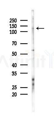 SUPT16H Antibody - Western blot analysis of lysates from Hela cells(heat-shock 45min treatment), using SUPT16H Antibody at 1/1000 dilution.