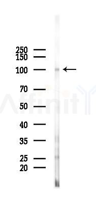 CADM1 Antibody - Western blot analysis of lysates from 293 cells(LPS 4h treatment), using CADM1 Antibody at 1/1000 dilution.
