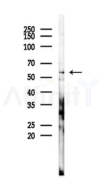 Cytochrome P450 2A13 Antibody - Western blot analysis of lysates from COLO205 cells(starvation 24h treatment), using Cytochrome P450 2A13 Antibody at 1/1000 dilution.