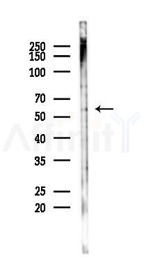 Cytochrome P450 2C8 Antibody - Western blot analysis of lysates from K562 cells(heat-shock 45min treatment), using Cytochrome P450 2C8 Antibody at 1/1000 dilution.