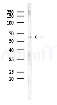 Cytochrome P450 3A4/5 Antibody - Western blot analysis of lysates from K562 cells(heat-shock 45min treatment), using Cytochrome P450 3A4/5 Antibody at 1/1000 dilution.