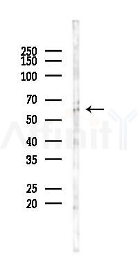 Cytochrome P450 3A4/5 Antibody - Western blot analysis of lysates from COLO205 cells(starvation 24h treatment), using Cytochrome P450 3A4/5 Antibody at 1/1000 dilution.