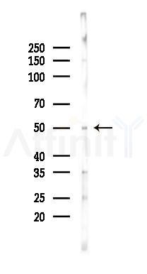 Cytochrome P450 4B1 Antibody - Western blot analysis of lysates from Rat testis, using Cytochrome P450 4B1 Antibody at 1/1000 dilution.
