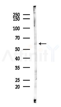 Cytochrome P450 7B1 Antibody - Western blot analysis of lysates from Rat brain, using Cytochrome P450 7B1 Antibody at 1/1000 dilution.