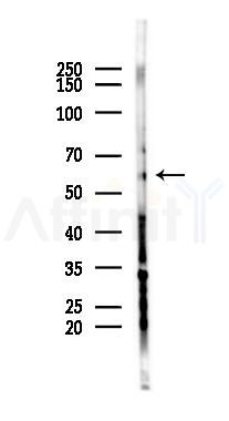 Cytochrome P450 7B1 Antibody - Western blot analysis of lysates from 293 cells(LPS 4h treatment), using Cytochrome P450 7B1 Antibody at 1/1000 dilution.