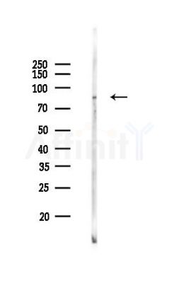IL17RA Antibody - Western blot analysis of lysates from Mouse muscle, using IL17RA Antibody at 1/1000 dilution.