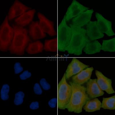 ELOA3 Antibody - DF3614 staining Hela cells(45min of heat-shock treatment) by IF/ICC.