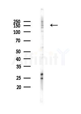 MLH3 Antibody - Western blot analysis of lysates from PC12 cells(heat-shock 45min treatment), using MLH3 Antibody at 1/1000 dilution.