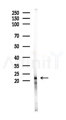 MRPL41 Antibody - Western blot analysis of lysates from Hela cells(heat-shock 45min treatment), using MRPL41 Antibody at 1/1000 dilution.