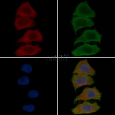 MRPL51 Antibody - DF3674 staining Hela cells(30min of UV treatment) by IF/ICC.